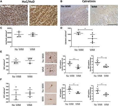 Interneuron Development Is Disrupted in Preterm Brains With Diffuse White Matter Injury: Observations in Mouse and Human